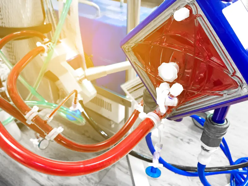 VIP BOLT interim analysis: VA-ECMO vs off-pump bilateral lung transplantation